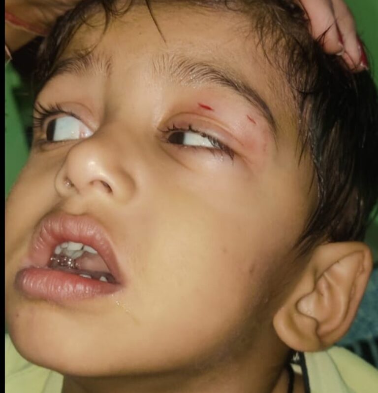 स्ट्रीट डॉग का आतंक , चार लोगों को किया घायल