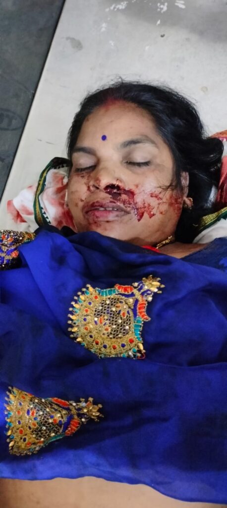 सनखेड़ा नाका रोड पर दर्दनाक हादसा: नाबालिगों की गाड़ी ने महिला को रौंदा, मौत; कई घायल I